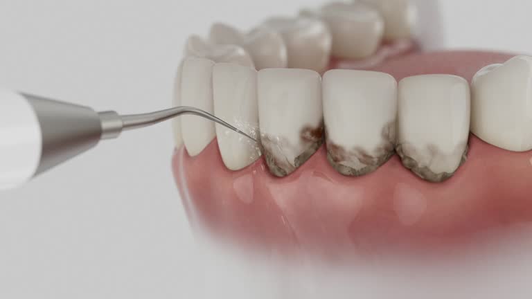Reliable Dental contractor in Baltimore, OH by Dentist Open Now